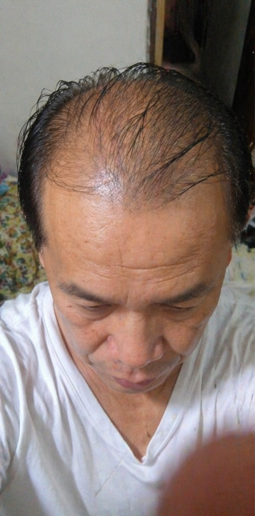 生发前