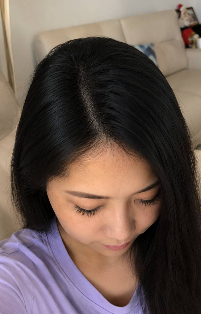 生发后