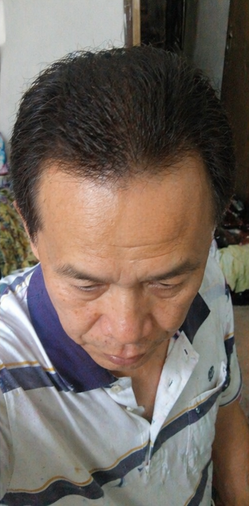 生发后